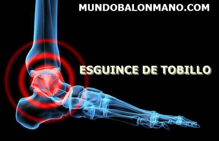 5-ESGUINCE-TORCEDURA-TOBILLO-MUNDOBALONMANO.COM